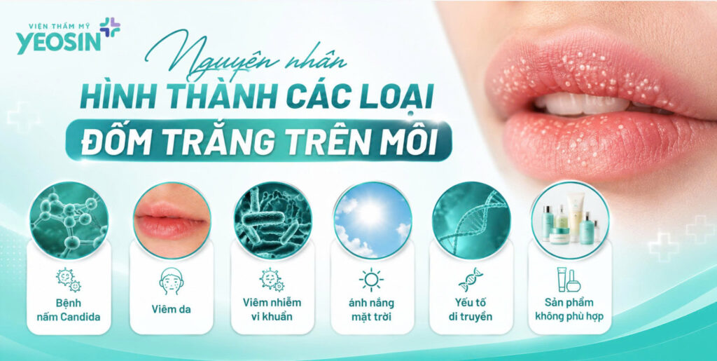Đốm trắng trên môi: Nguyên nhân và cách điều trị 7 1788162285910 543195267361827872 301541920615582086 e18baadd4065169294b19f7da07ed853
