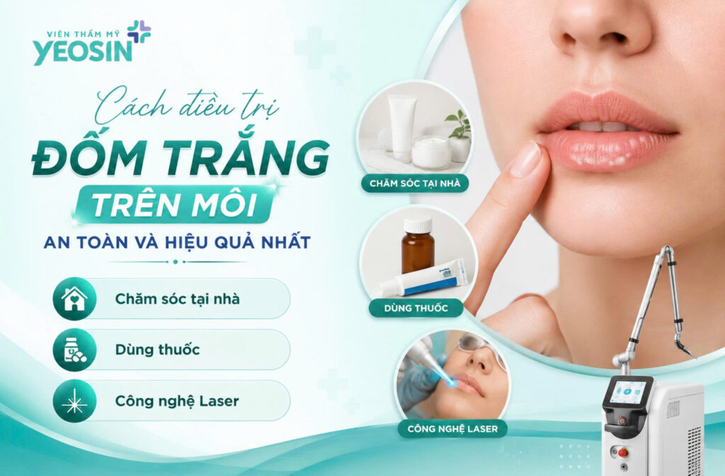 Đốm trắng trên môi: Nguyên nhân và cách điều trị 8 1788162517941 543195267361827872 301541920615582086 b6c927f579a10c92676661c891f0566d