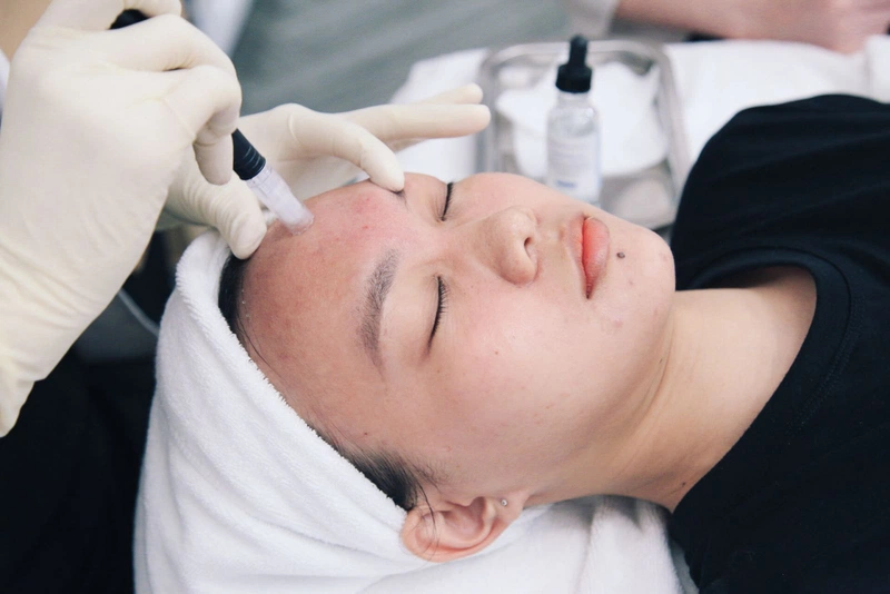 Cách Lựa Chọn Liệu Trình Trị Mụn Phù Hợp
