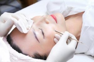 bảng giá điều trị mụn
