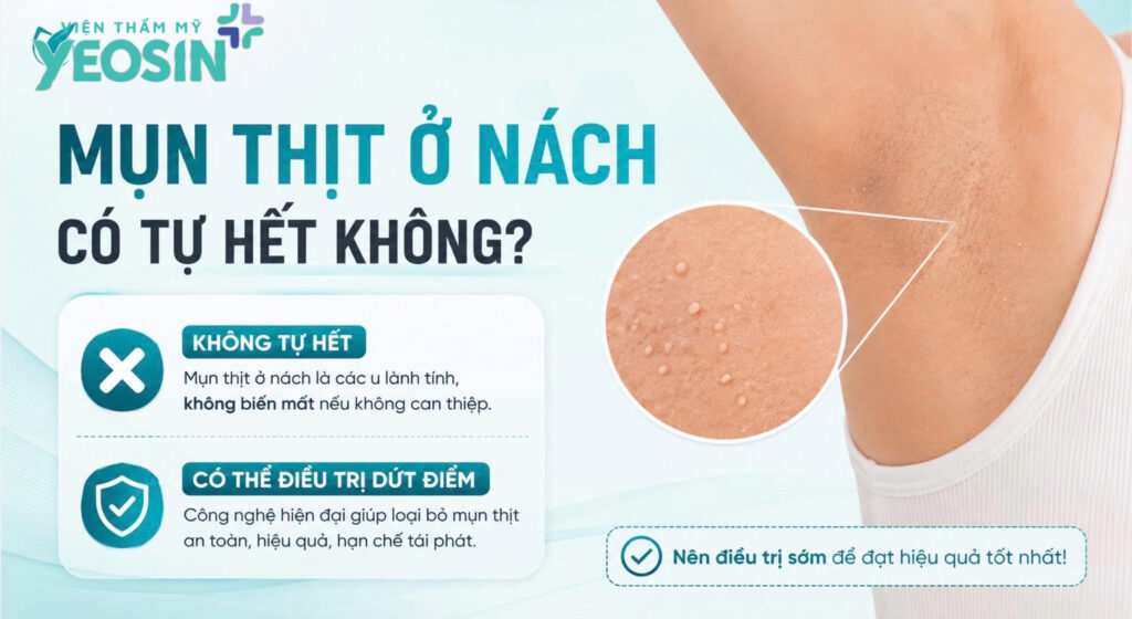 Mụn thịt ở nách: Nguyên nhân, cách xử lý hiệu quả 8 Mụn thịt ở nách có tự hết không?