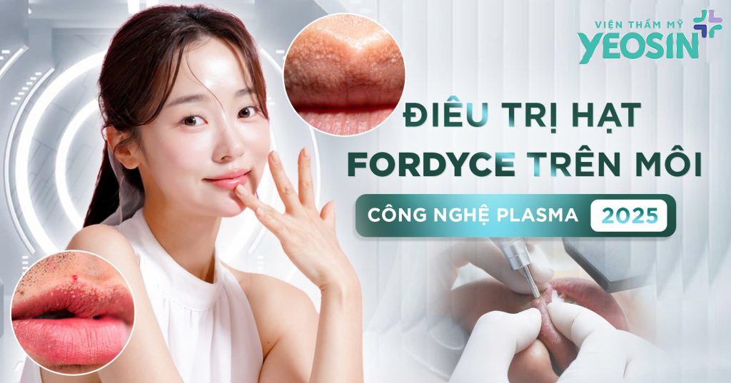 Viện Thẩm Mỹ Yeosin – Địa chỉ trị hạt fordyce an toàn và uy tín tại Tphcm
