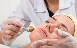 liệu trình lăn kim trị mụn giá bao nhiêu