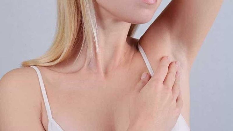 mụn thịt ở nách