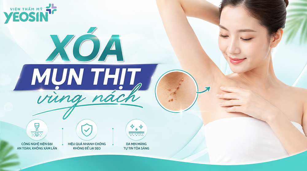 Nách bị đốm nâu: Nguyên nhân và cách xử lý hiệu quả 12 Xóa mụn thịt vùng nách
