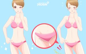 Những lưu ý sau khi triệt lông bikini lần đầu bạn cần biết