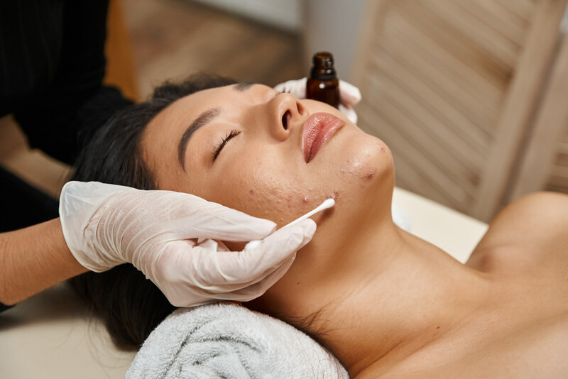Điều trị mụn gồm những gì? Các phương pháp phổ biến hiện nay