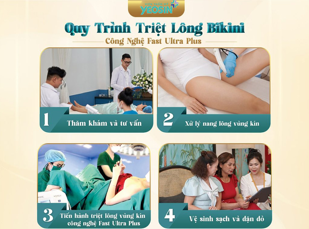 Vùng bikini là vùng nào? Tác hại của triệt lông vùng kín sai cách 3 Quy trình triệt lông bikini an toàn và hiệu quả