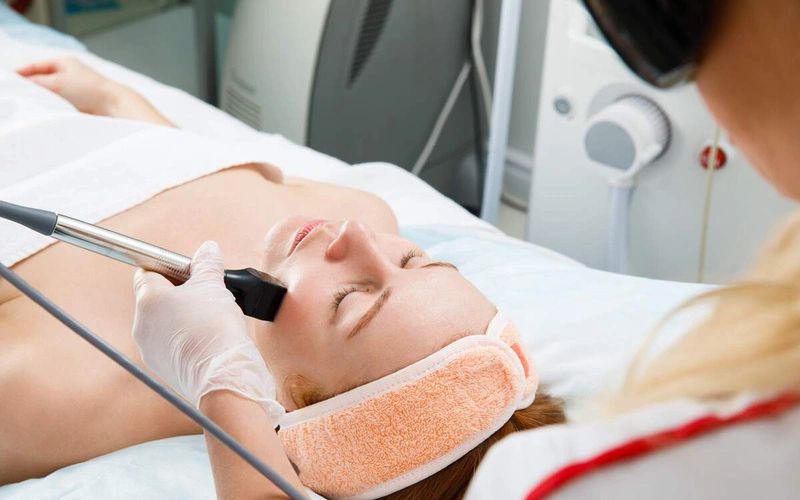 trị mụn bằng laser giá bao nhiêu