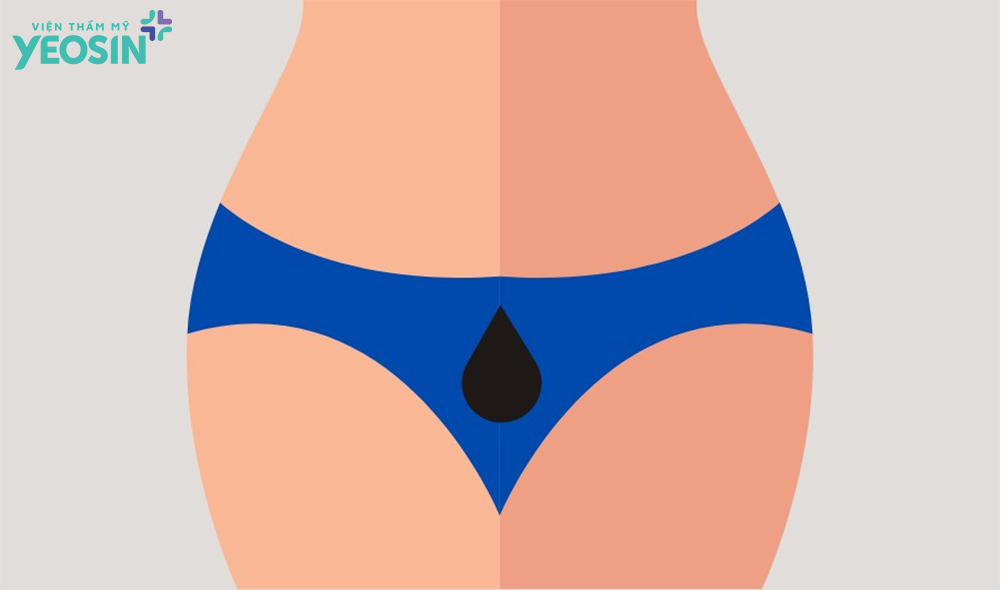 Vùng bikini là vùng nào? Vùng bikini là vùng nào?