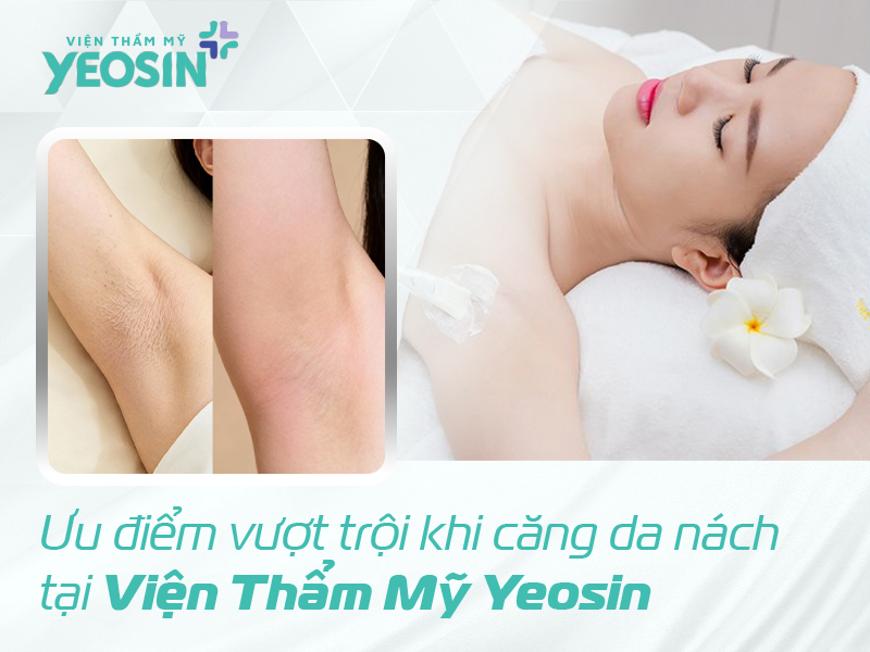 Căng da nách - Giải pháp cải thiện tình trạng da nách chảy xệ 12 Ưu điểm vượt trội khi căng da nách tại Yeosin