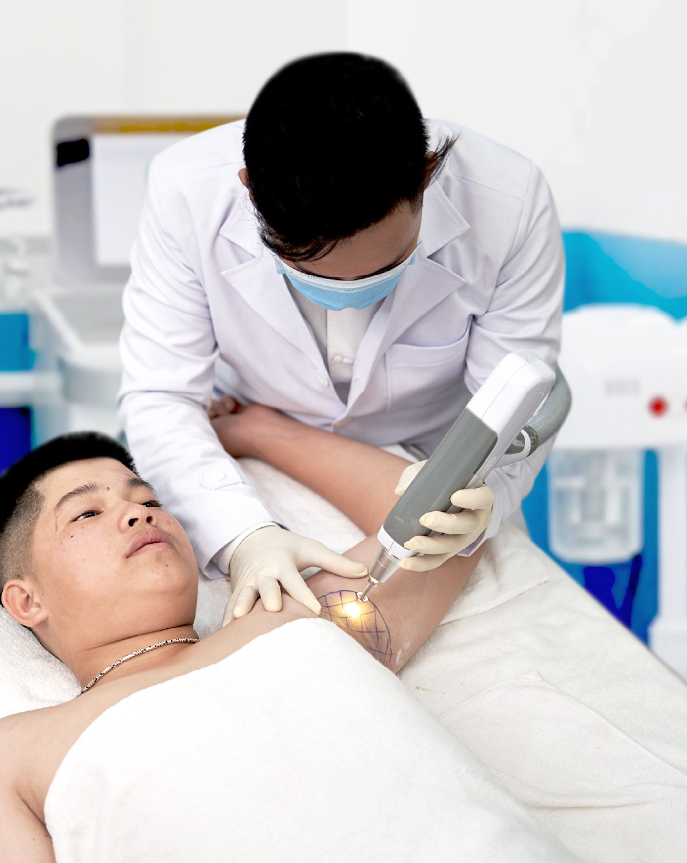 Trị Hôi Nách 12 5.HINH ANH DUNG TIA PALAMAS PHA HUY VUNG TANG TIET QUY TRINH FAST ARMPIT