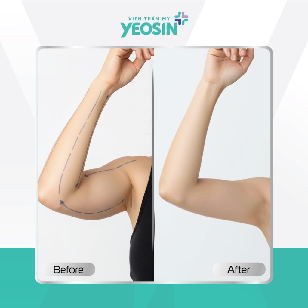 Hình fb từ khách hàng 20