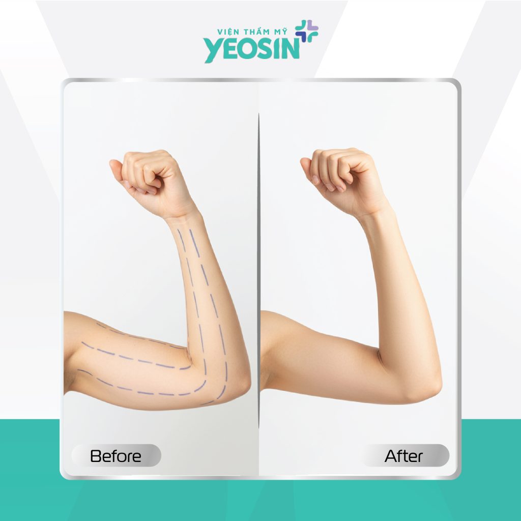 Hình fb từ khách hàng 22