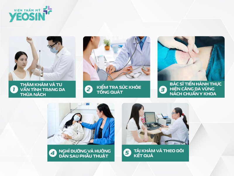 Căng da nách - Giải pháp cải thiện tình trạng da nách chảy xệ 13 Quy trình căng da nách tại Phòng Khám Thẩm Mỹ Yeosin
