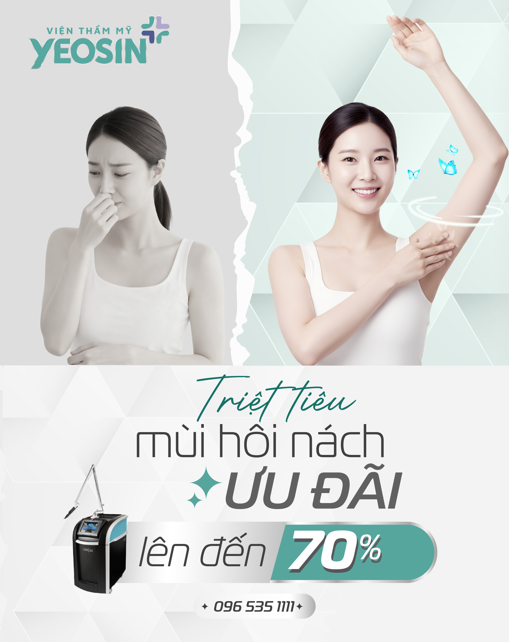Trị Hôi Nách 37 banner mobile 2