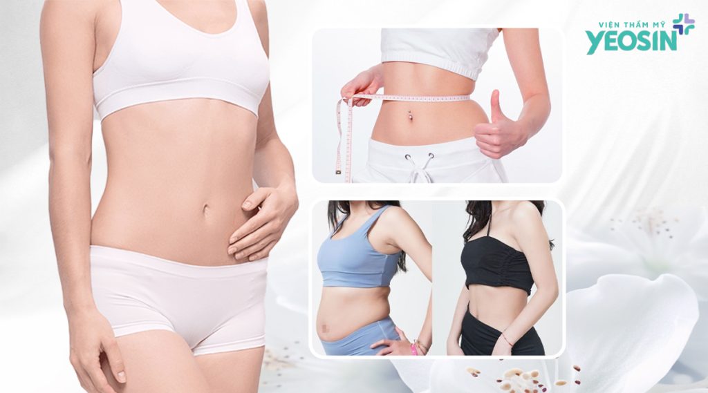 Hiệu quả nhận được sau khi hút mỡ 360 độ