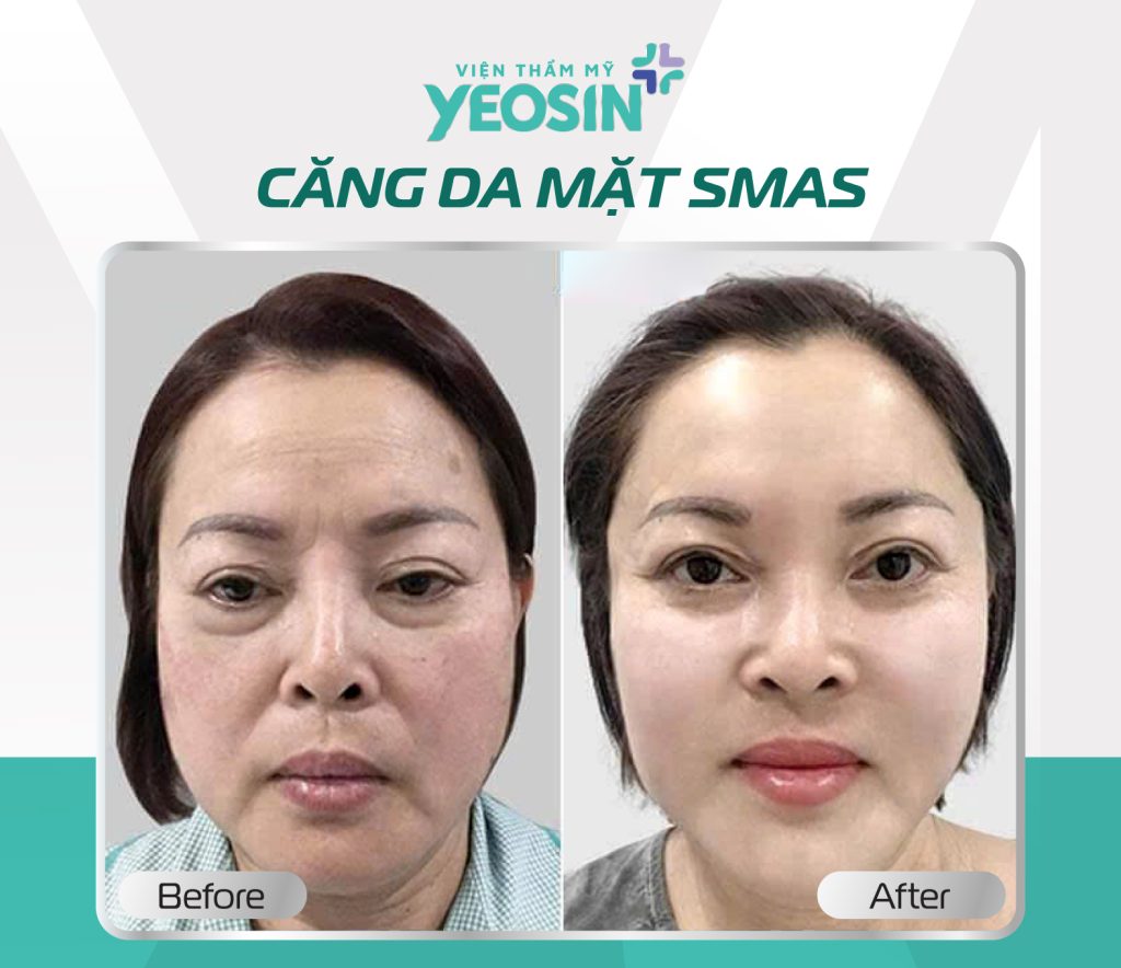 Hình fb từ khách hàng1