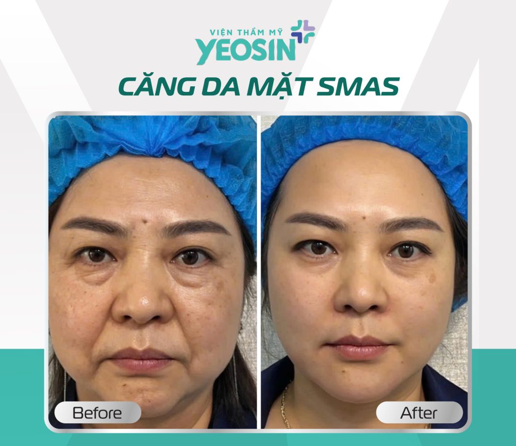 Hình fb từ khách hàng2