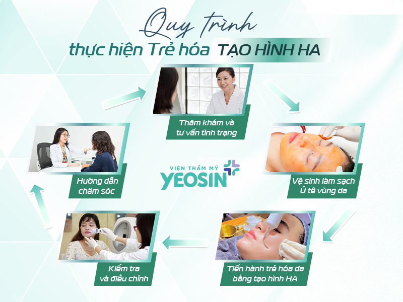 Trẻ hóa da bằng tạo hình HA Filler 16 Quy trình trẻ hóa da bằng tạo hình HA.