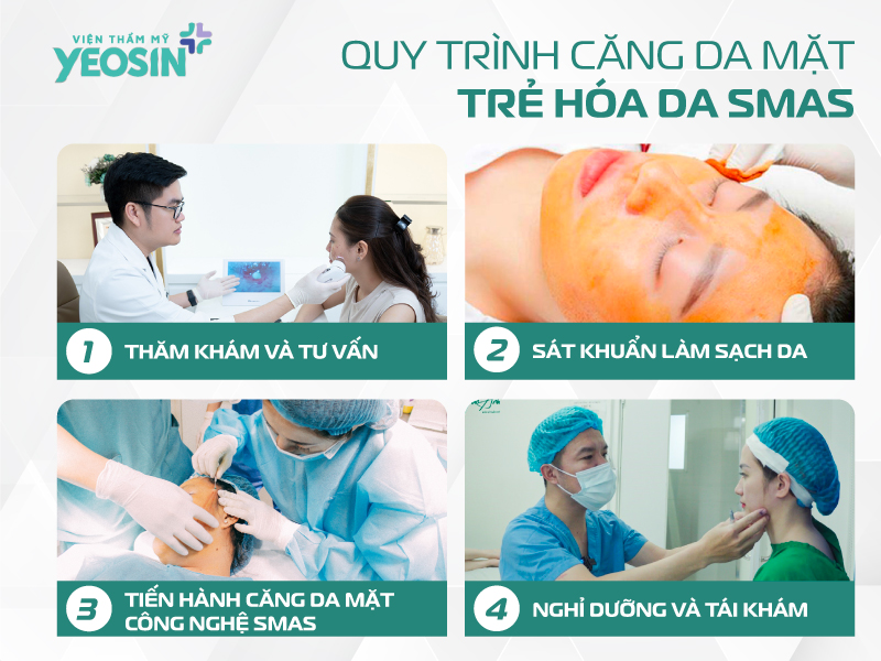 Quy trình căng da mặt trẻ hóa da Smas tại Viện Thẩm Mỹ Yeosin
