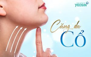 Căng da cổ 9 căng da cổ