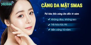 căng da mặt trẻ hóa da smas