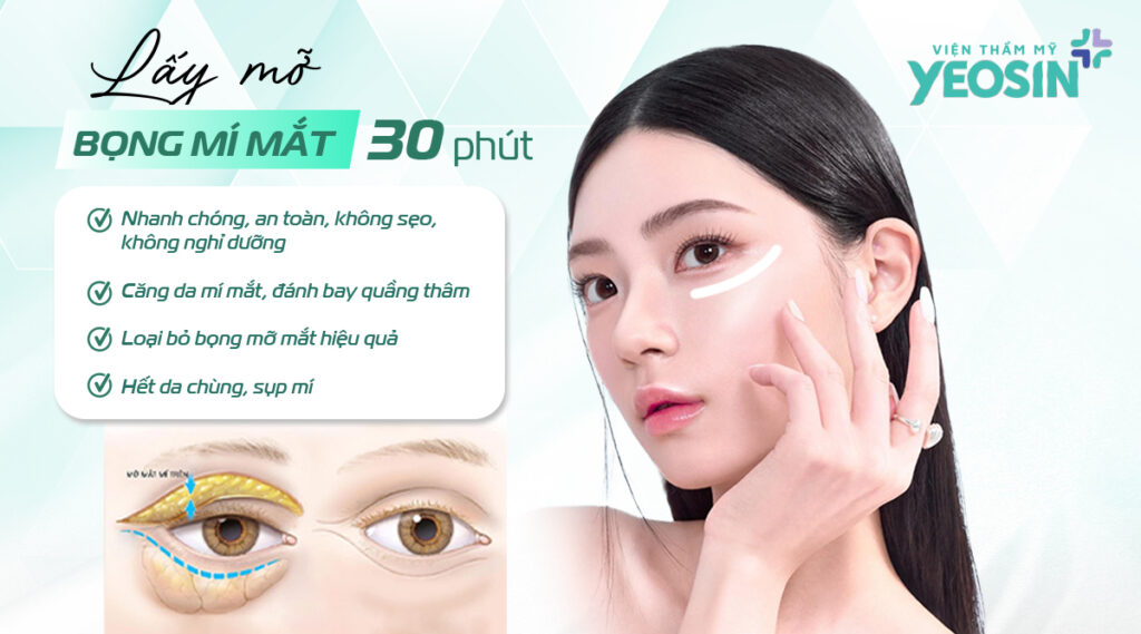Lấy mỡ thừa mí mắt trên dưới 13 Lấy mỡ thừa mí mắt, mỡ bọng mắt là gì?