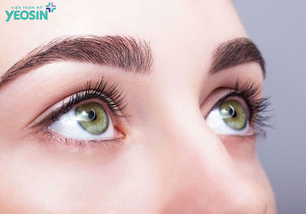 Những lưu ý quan trọng sau khi lấy mỡ bọng mắt bạn cần biết