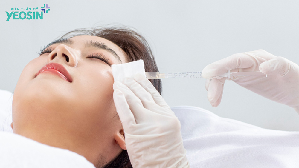 Trẻ hóa da bằng tạo hình HA Filler 7 Trẻ hóa da bằng tạo hình HA là gì