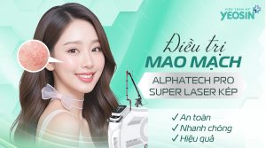 điều trị giãn mao mạch