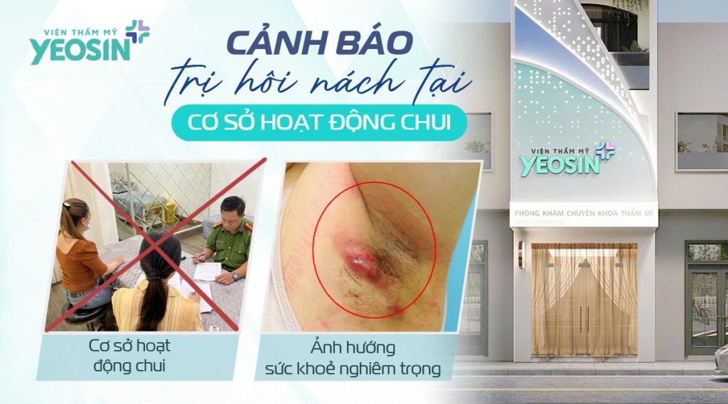 Phòng khám điều trị hôi nách có hiệu quả không?