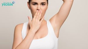 Điều trị hôi nách có hết không?