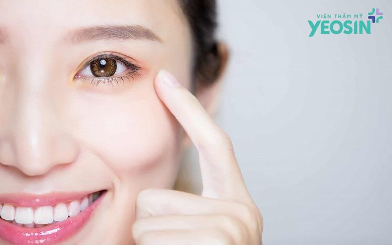 Cắt mí mắt chuẩn Yeosin - Đẹp tự nhiên, không lộ dấu vết thẩm mỹ 10 2