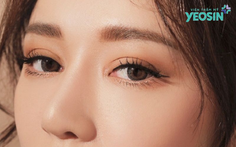 Cắt mí mắt chuẩn Yeosin - Đẹp tự nhiên, không lộ dấu vết thẩm mỹ 16 Thiet ke chua co ten