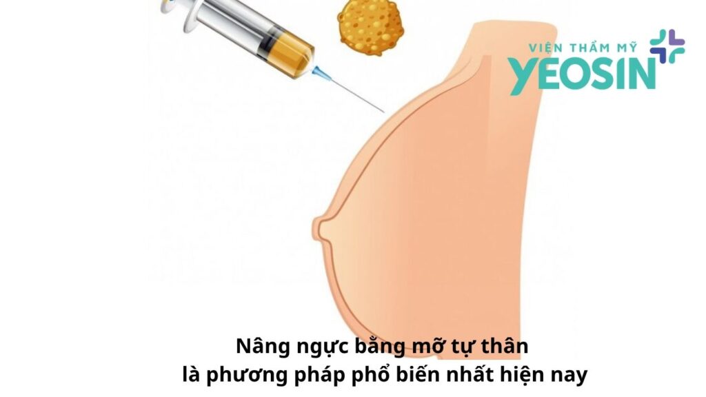 Nâng ngực bằng mỡ tự thân là phương pháp phổ biến nhất hiện nay Nâng ngực bằng mỡ tự thân là phương pháp phổ biến nhất hiện nay