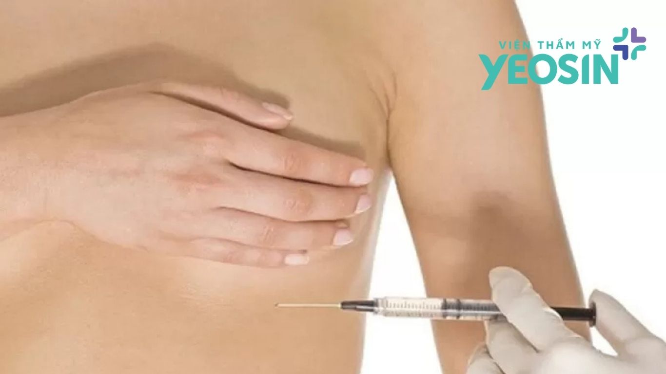 Nâng ngực không phẫu thuật là phương pháp ít xâm lấn, giúp tăng vòng 1 tự nhiên. Chi phí nâng ngực không phẫu thuật