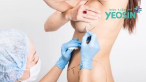 Nâng ngực không phẫu thuật tại Viện Thẩm Mỹ YeosinNâng ngực không phẫu thuật tại Viện Thẩm Mỹ Yeosin