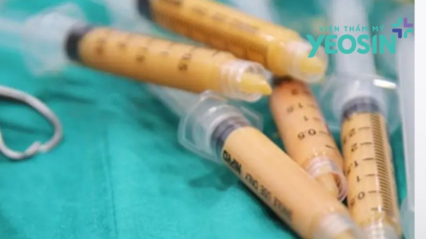 Chi phí nâng ngực bằng mỡ tự thân phụ thuộc nhiều yếu tố khác nhau. Chi phí nâng ngực bằng mỡ tự thân phụ thuộc nhiều yếu tố khác nhau