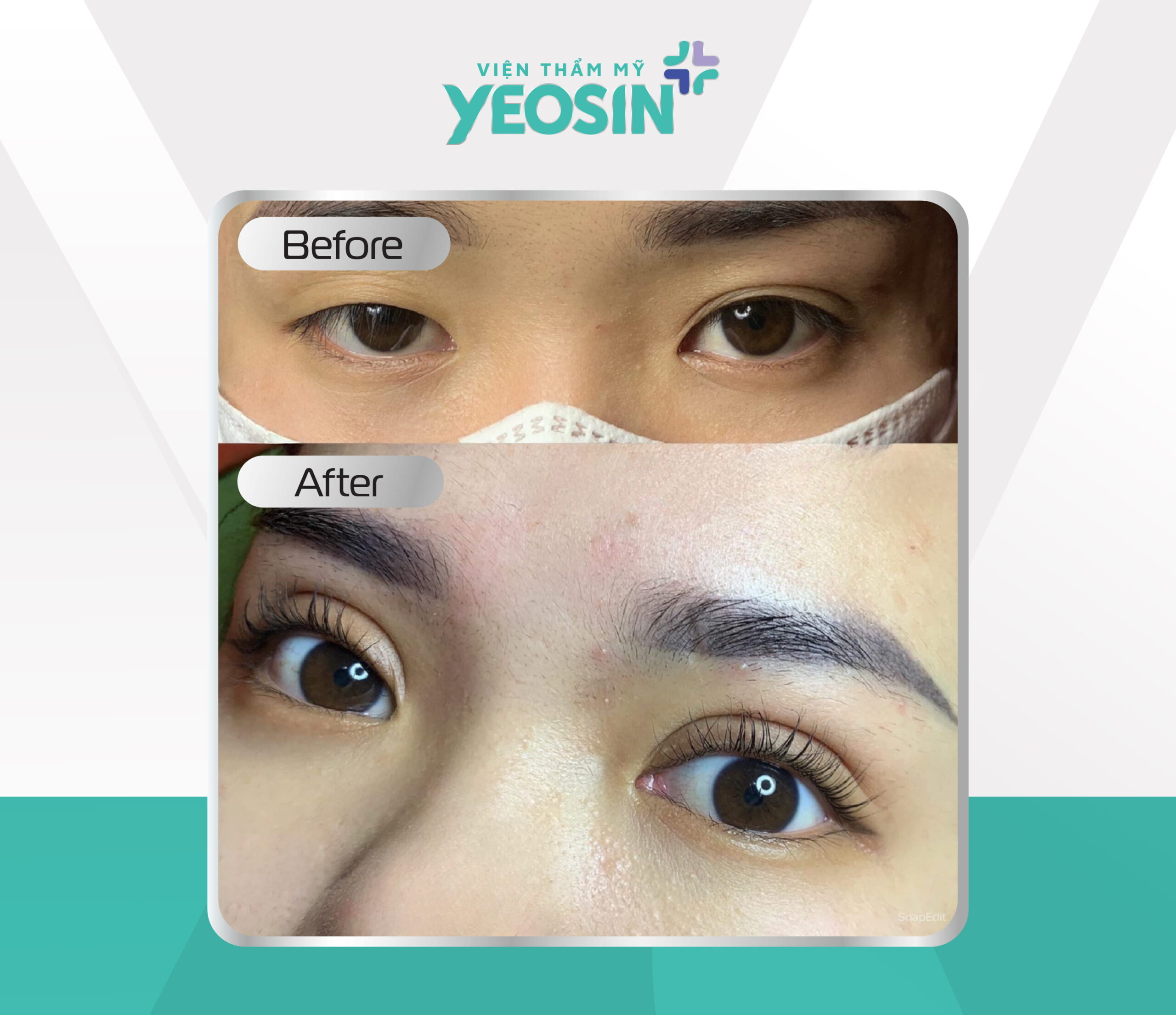 Hinh truoc sau 06 1 scaled