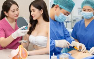 co nen nang nguc cay mo tu than ava