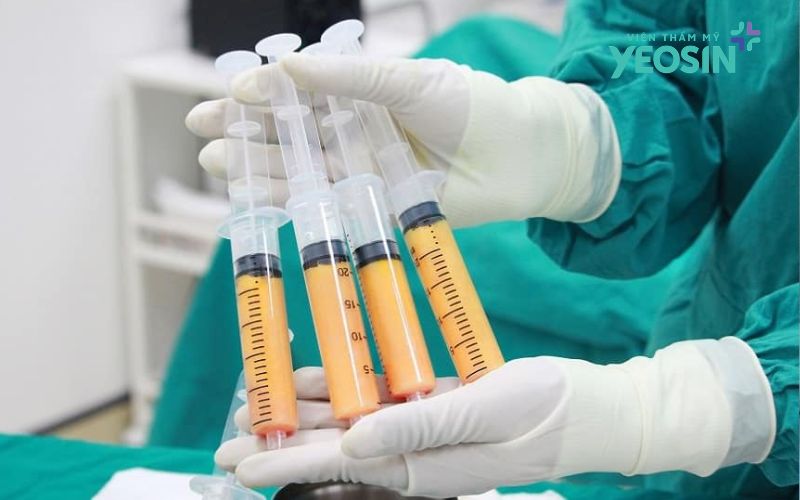 Nâng ngực bằng mỡ tự thân được bao lâu