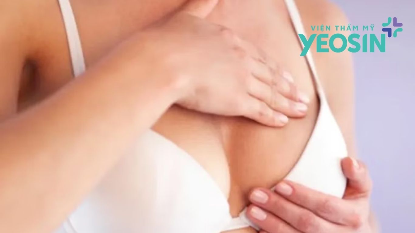 Cách nâng ngực bằng mỡ tự thân Cách nâng ngực bằng mỡ tự thân