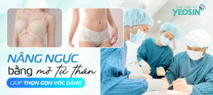 Nâng ngực cấy mỡ tự thân giúp thon gọn vóc dáng
