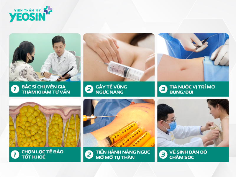 Quy trình nâng ngực cấy mỡ tự thân chuẩn y khoa tại Yeosin Quy trình nâng ngực cấy mỡ tự thân chuẩn y khoa tại Yeosin