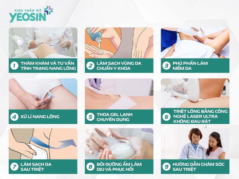 Quy trình triệt lông cho nam giới tại Viện Thẩm Mỹ Yeosin