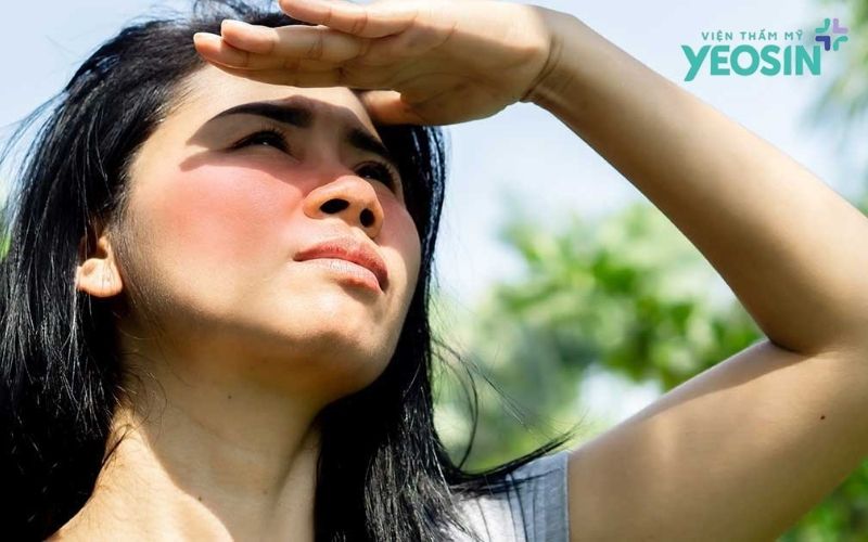 Nám Da Sau Sinh Có Tự Hết Không? Cách Cải Thiện An Toàn Và Hiệu Quả
