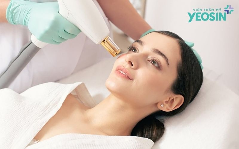 Bí Quyết Trị Quầng Thâm Mắt Dứt Điểm Và An Toàn