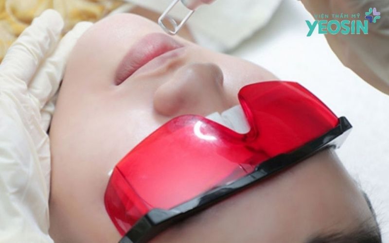 Đốt hạt Fordyce tại Yeosin - Giải pháp cải thiện đốm trắng trên môi bằng công nghệ Plasma 11 Công Nghệ Plasma Điều Trị Hạt Fordyce Hoạt Động Thế Nào?