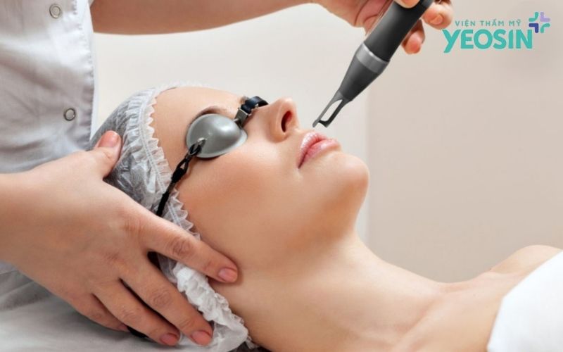Vì sao Filling Scars được nhiều khách hàng lựa chọn?